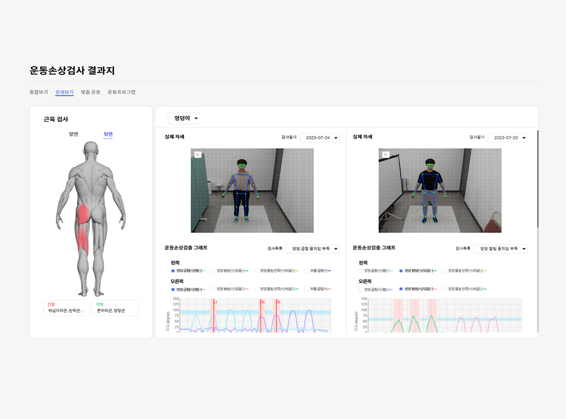 4DEYE Dx 관절 기능장애·보상작용 검출 실측 화면